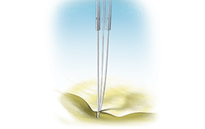 New-Talon-Anchoring-Spike